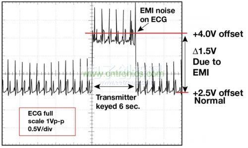 1.5 英尺以外的發(fā)射器（f = 470 MHz, P= 0.5W）開啟和關閉時ECG 診斷設備的心臟檢查結果